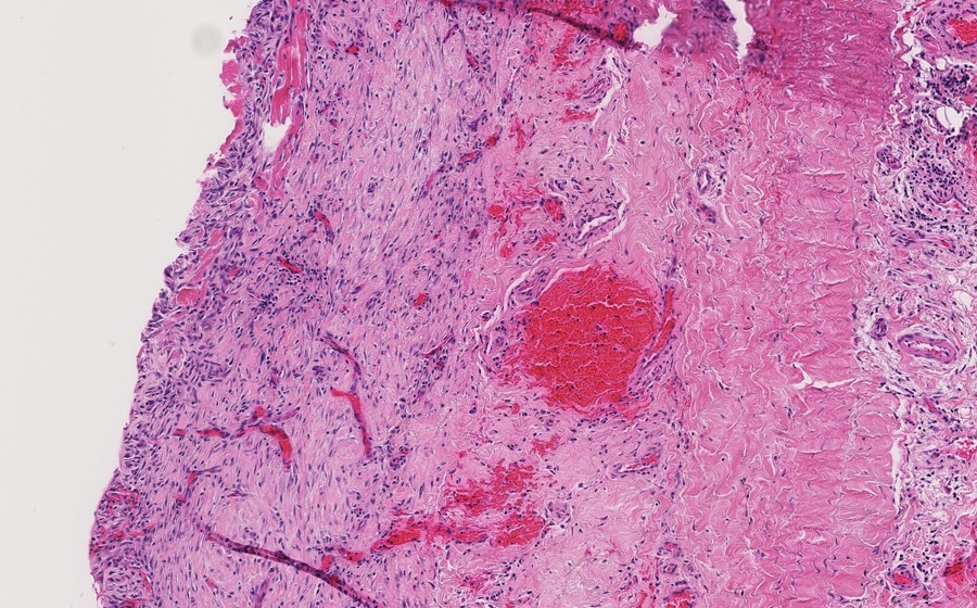 Slide 1 - Image 12