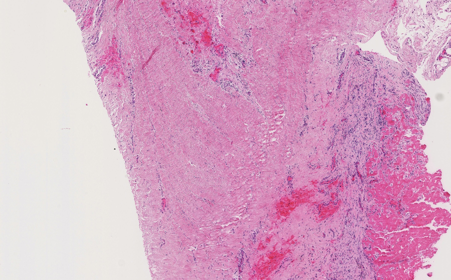 Slide 1 - Image 16