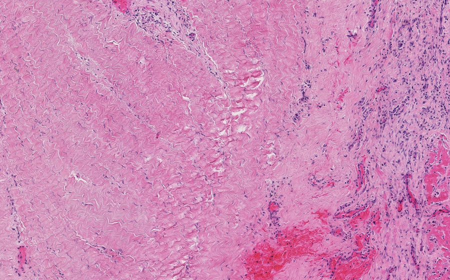 Slide 1 - Image 17