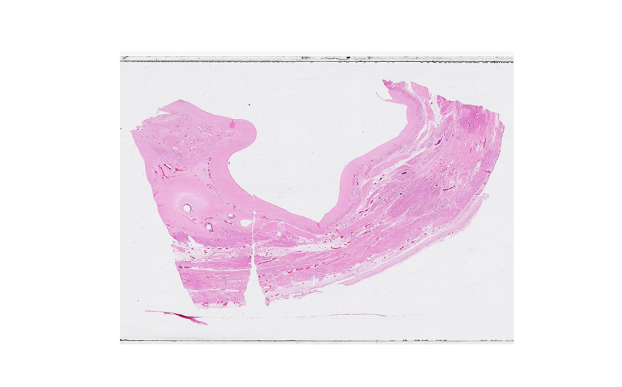 Normal Image 1