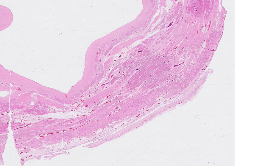 Normal Image 2