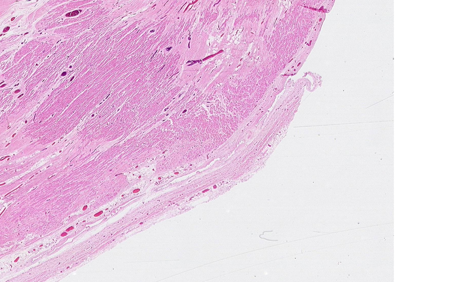 Normal Image 3