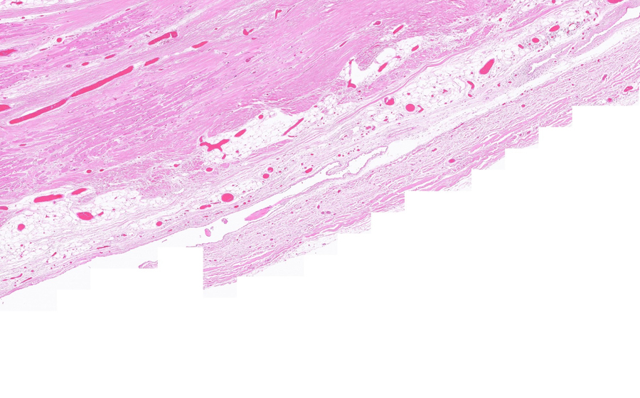 Normal Image 4