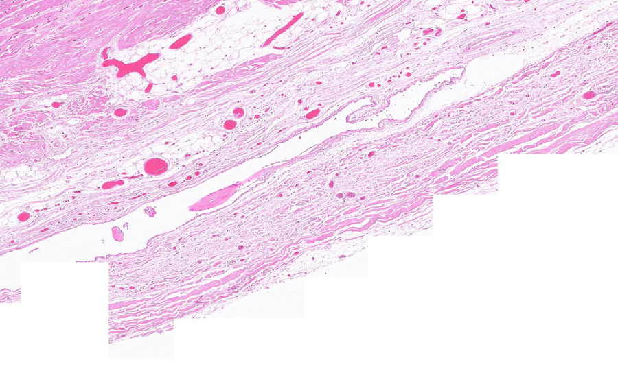 Normal Image 6