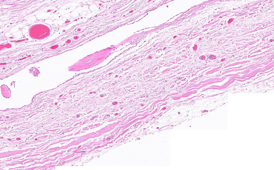 Normal Image 8