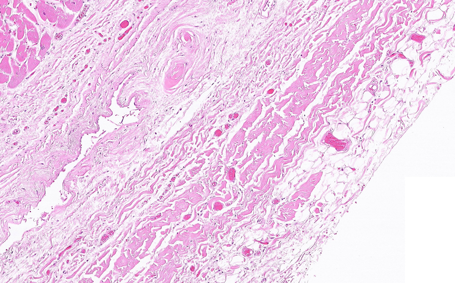 Normal Image 9