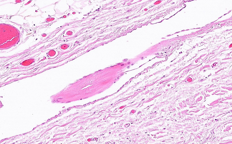 Normal Image 10