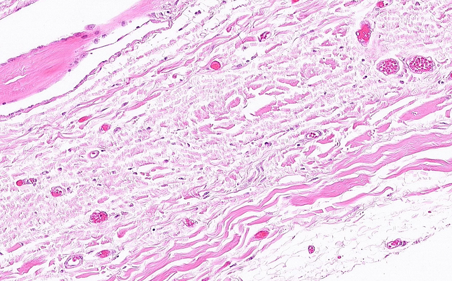 Normal Image 11