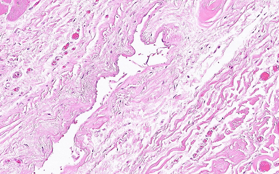 Normal Image 13