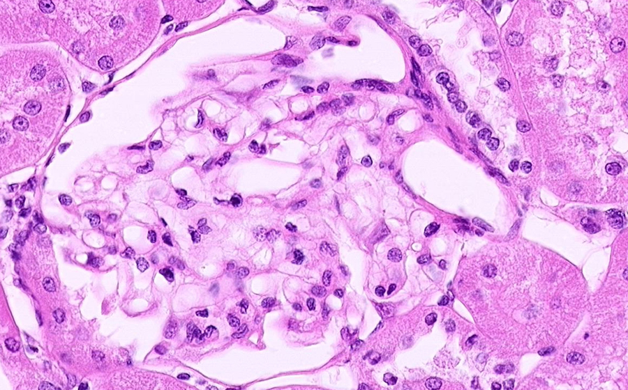 Normal Image 4