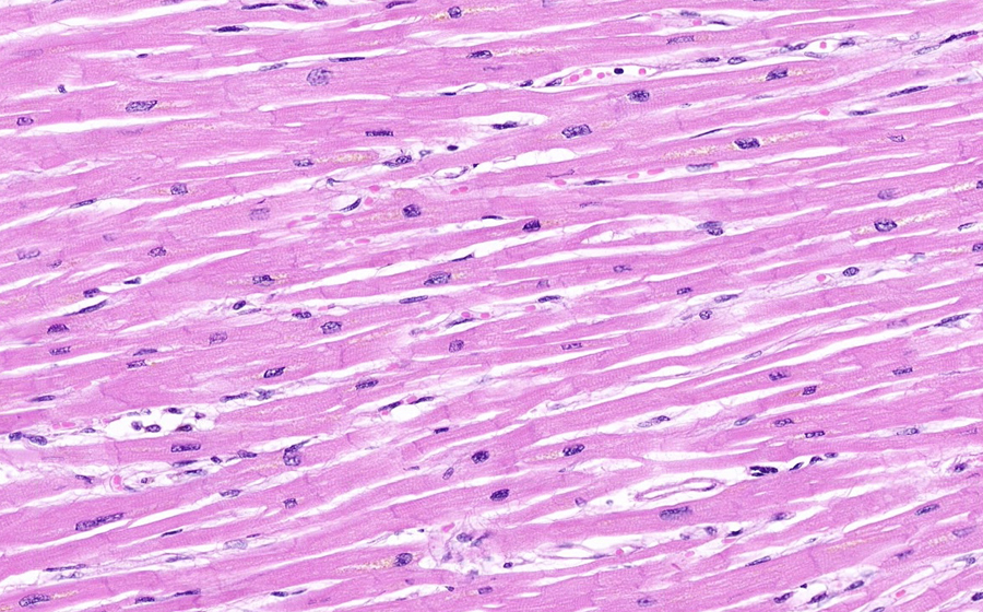 Normal Image 1