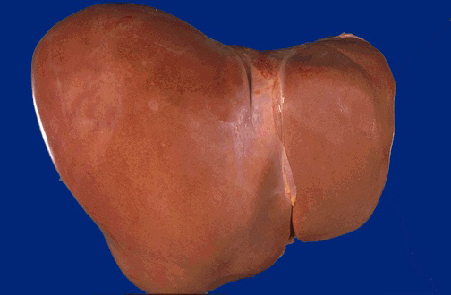Normal liver