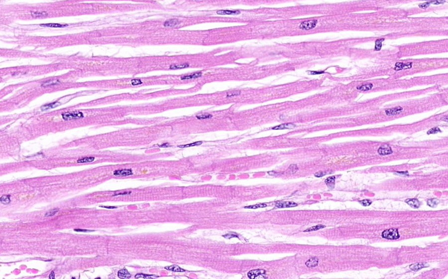 Image 3: Myocardial hypertrophy