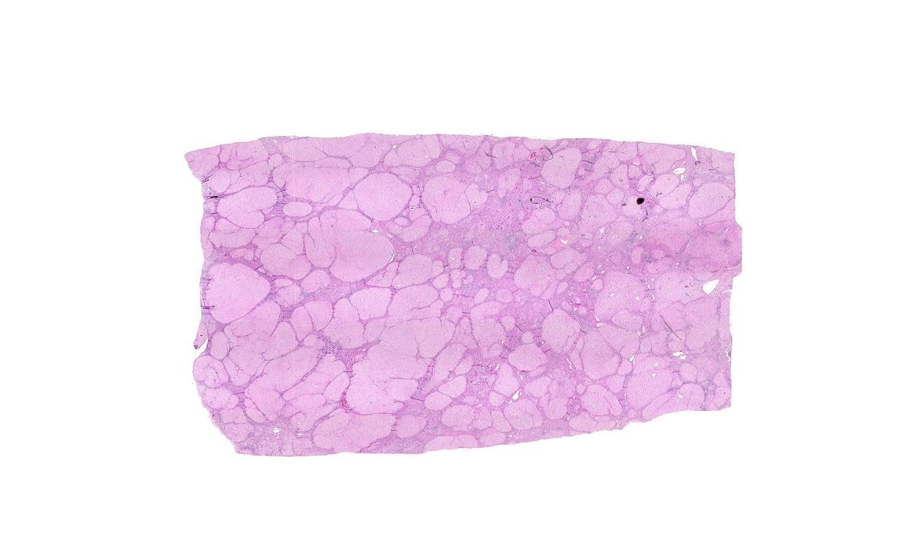 Slide 2 - Image 1