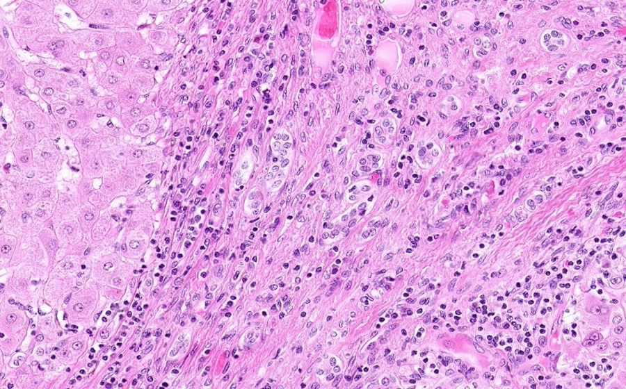 Slide 2 - Image 10