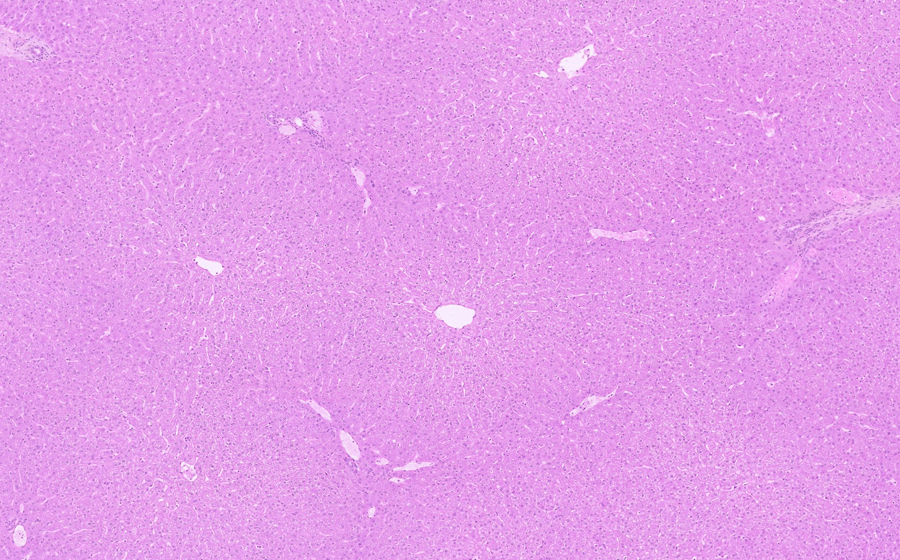 Normal Slide - Image 1