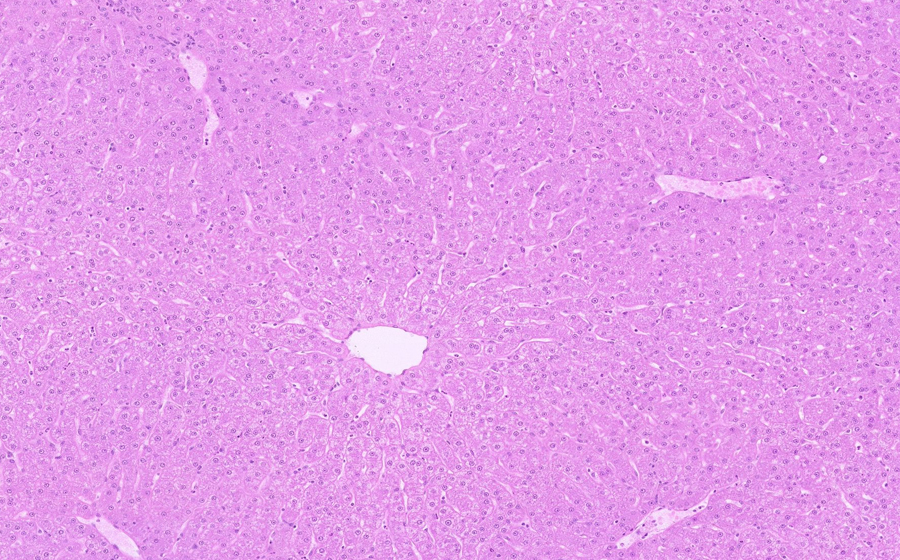 Normal Slide - Image 2