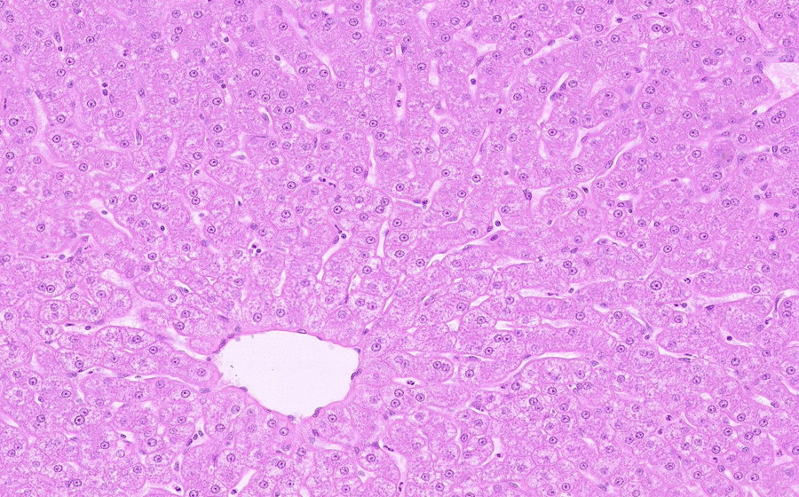 Normal Slide - Image 3