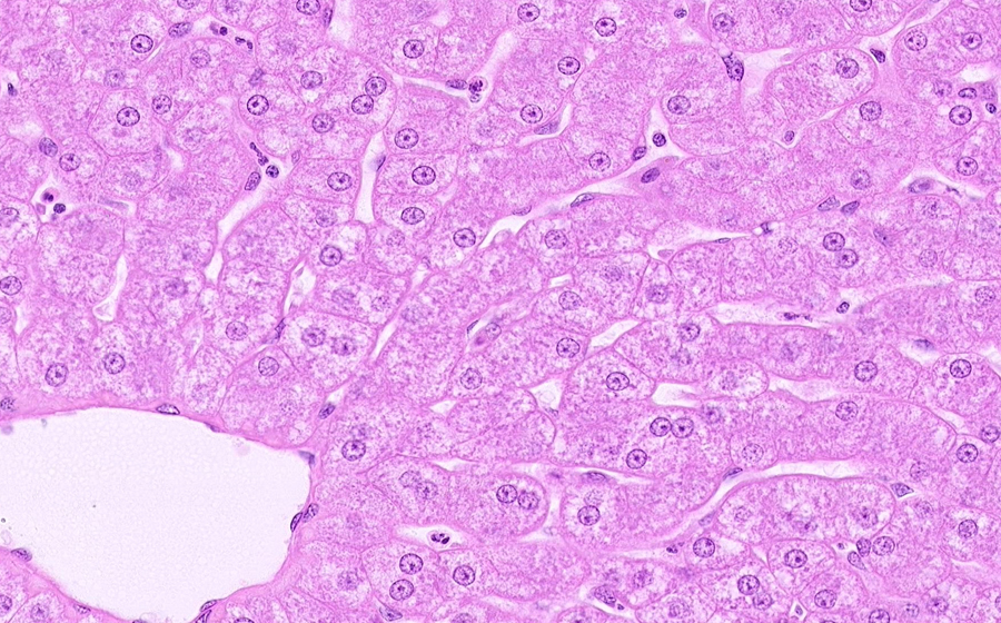 Normal Slide - Image 4