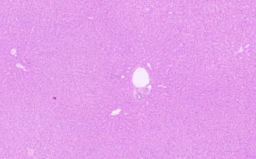 Normal Slide - Image 5