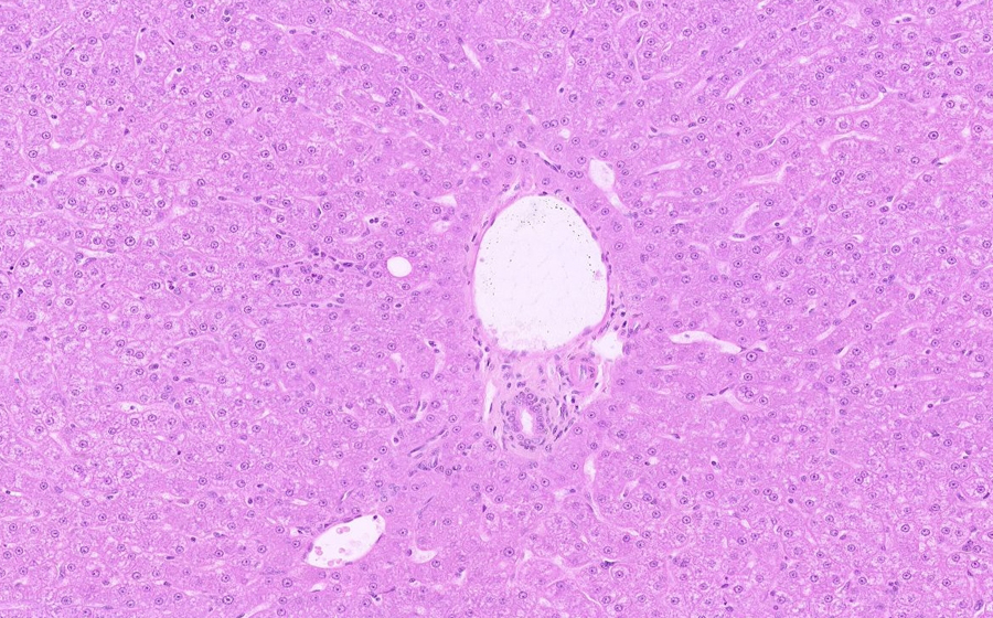 Normal Slide - Image 6