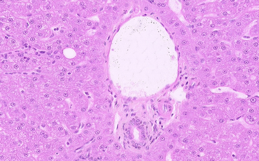 Normal Slide - Image 7
