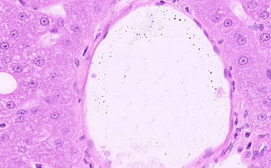 Normal Slide - Image 8