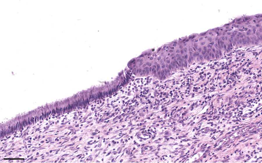 Normal Slide - Image 1