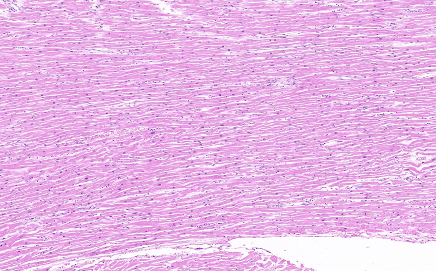 Normal slide - Image 1
