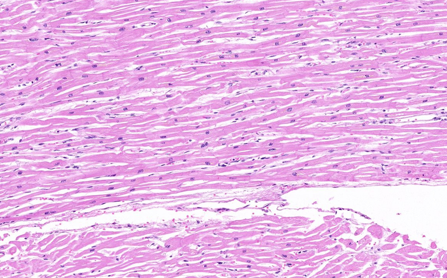 Normal slide - Image 2