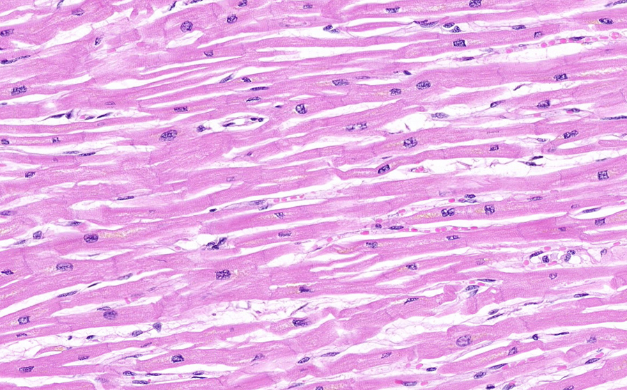 Normal slide - Image 3