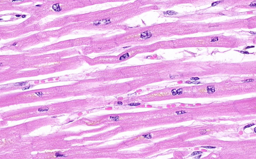 Normal slide - Image 4