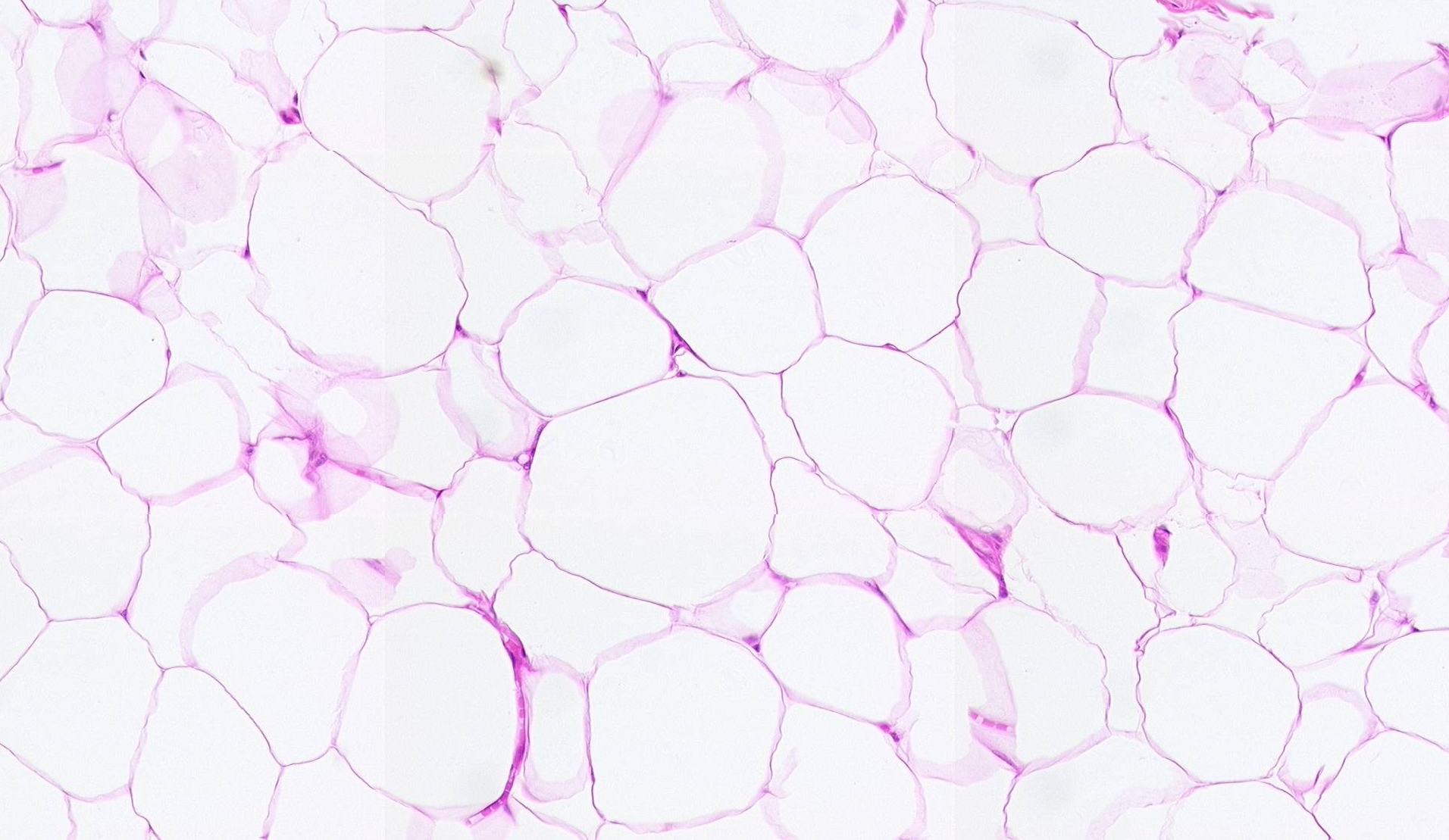 Normal image - Slide 1
