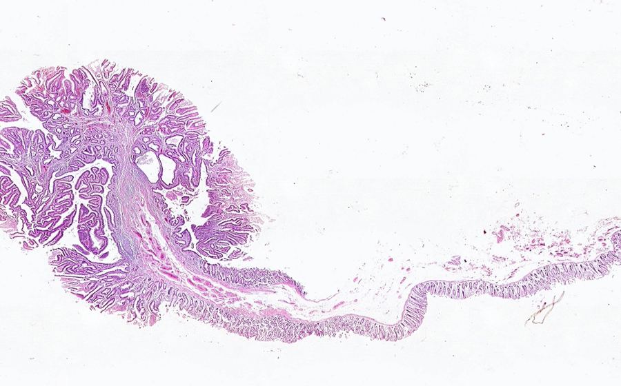 Slide 1 - Image 1