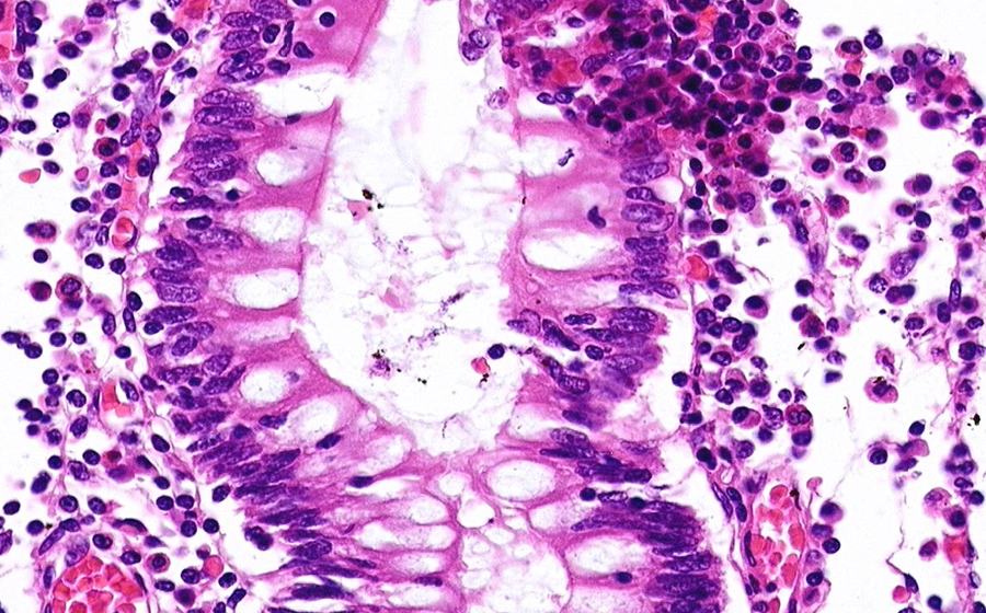 Slide 1 - Image 13