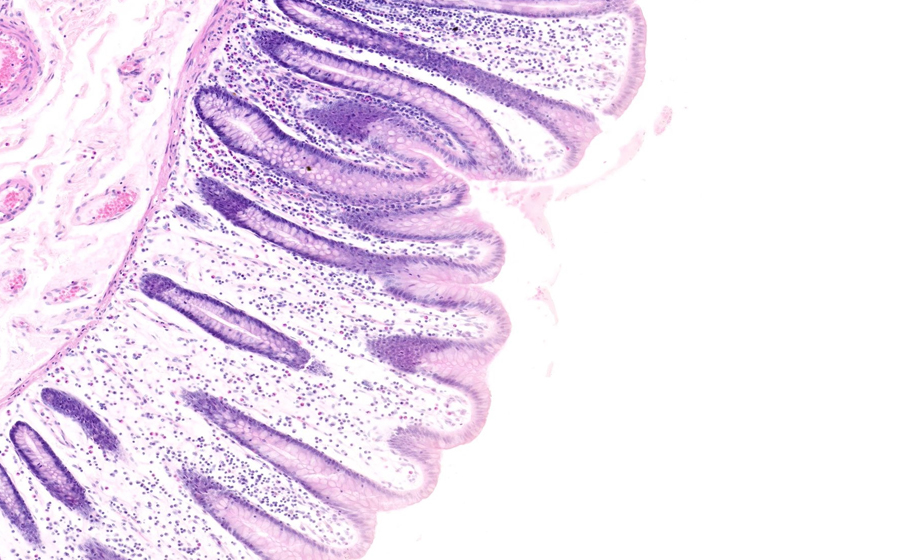 Slide 1 - Image 1