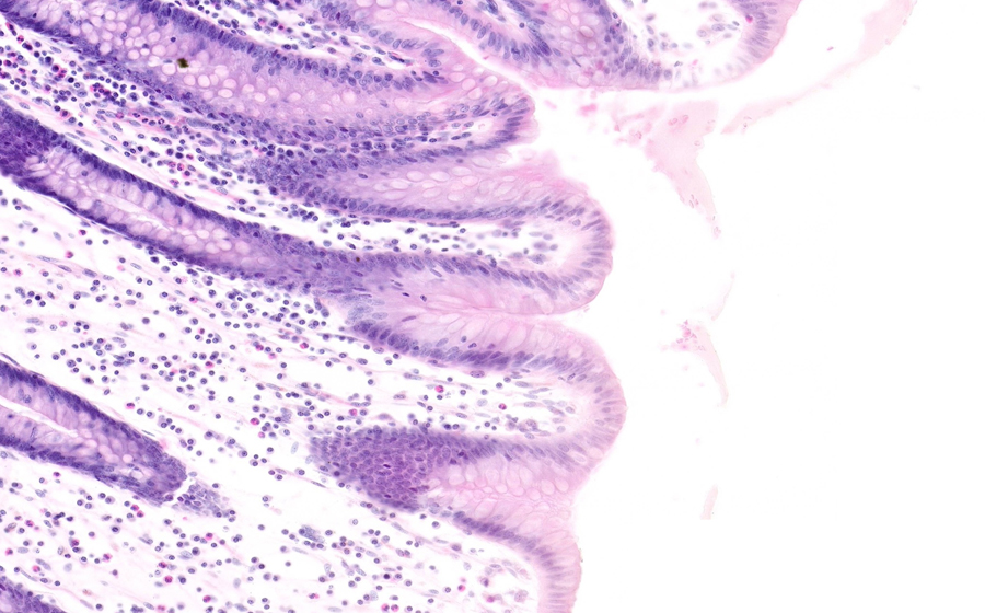 Slide 1 - Image 