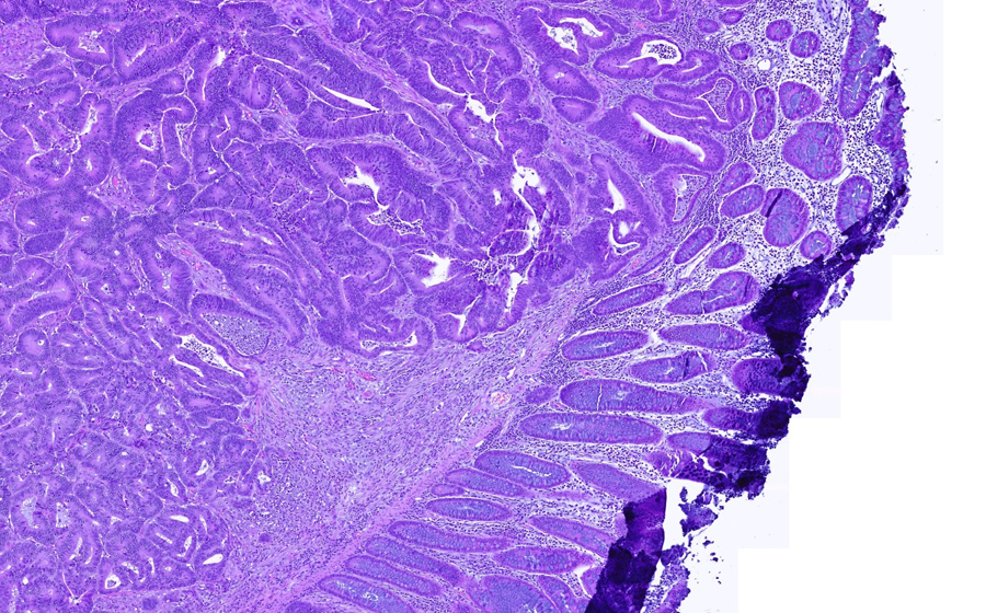Slide 2 - Image 3