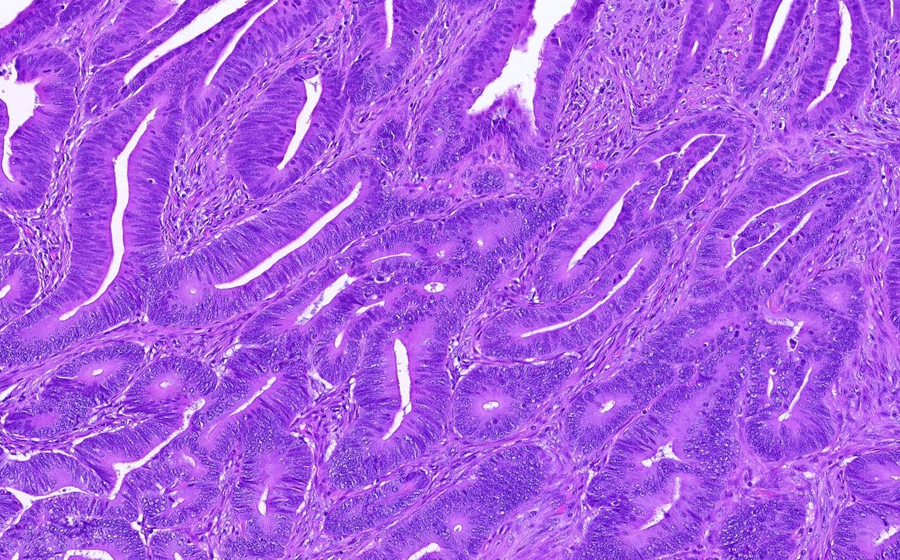 Slide 2 - Image 11