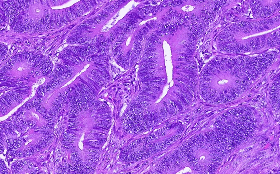 Slide 2 - Image 12