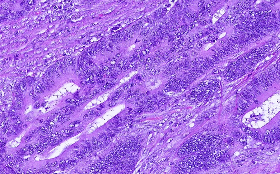 Slide 2 - Image 15