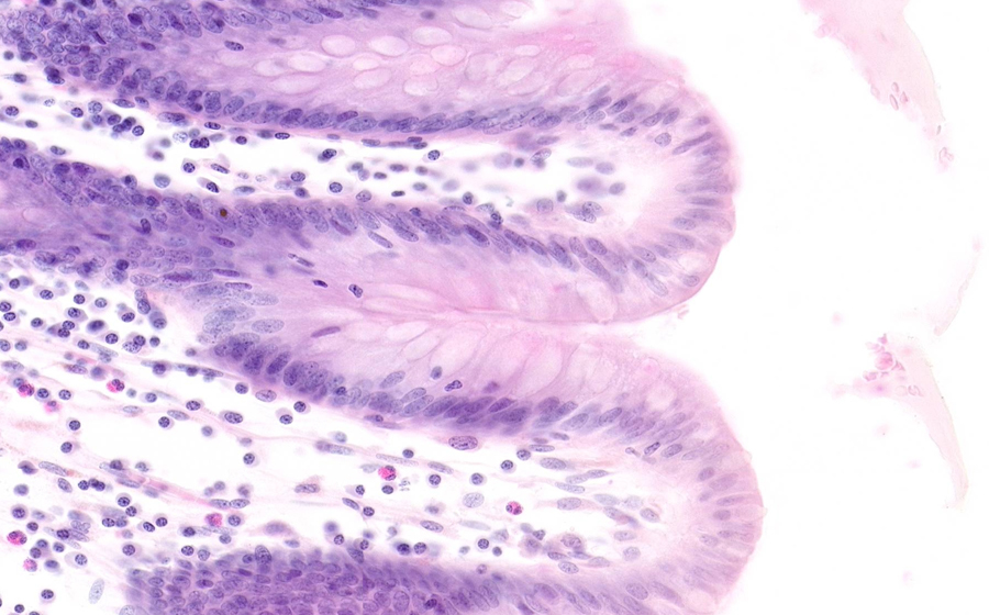 Normal Image 3