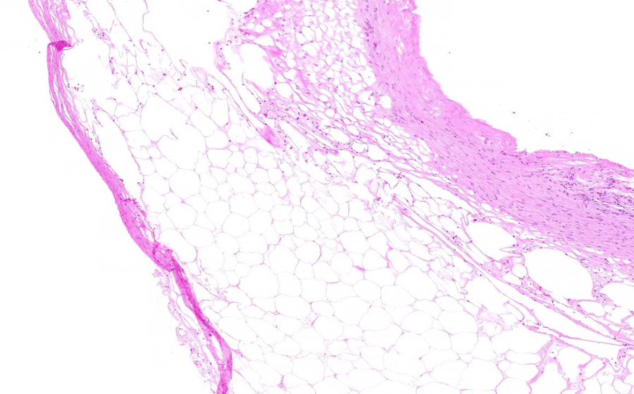 Slide 4 - Image 2