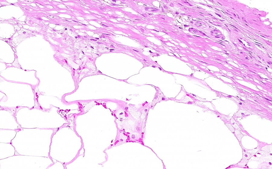 Slide 4 - Image 4