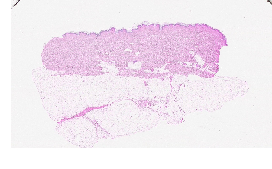Normal Image 1