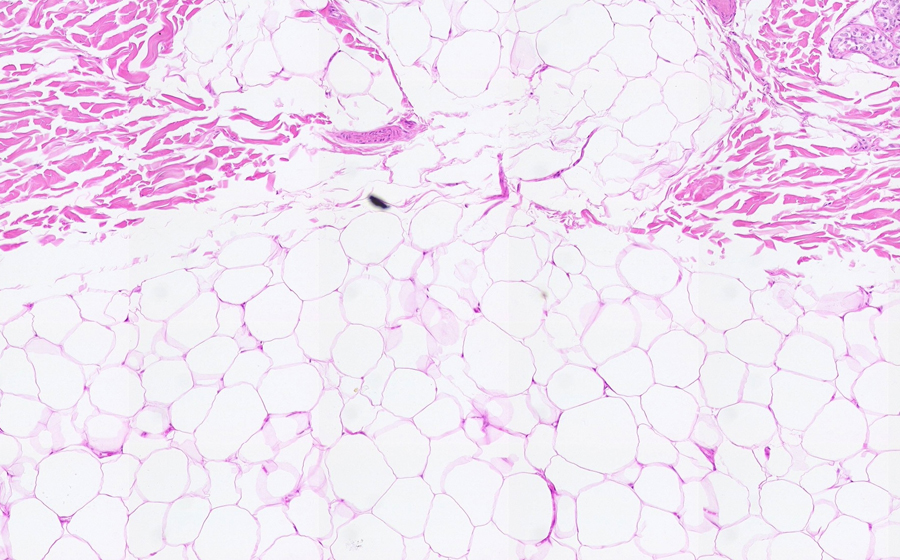 Normal Image 2