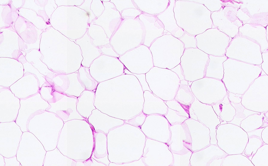 Normal Image 3