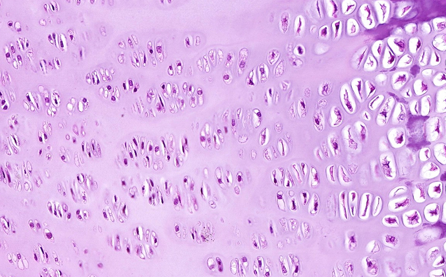 Image 4 - cartilage