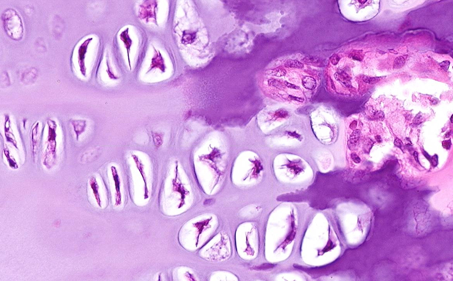 Image 5 - cartilage