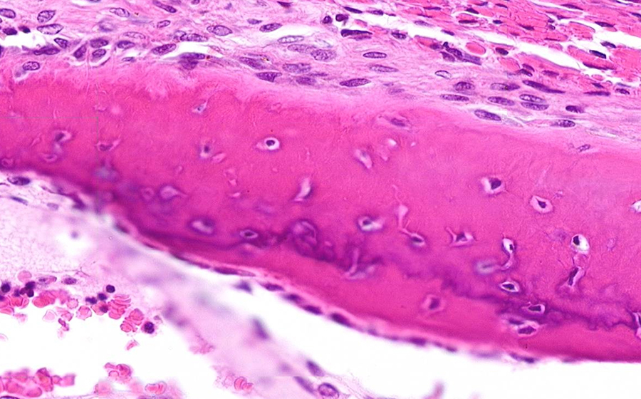Image 7 - cartilage